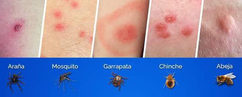 Pagina 7 - blog farmacia - Farmacia 24 horas Palma | Farmacia Balanguera