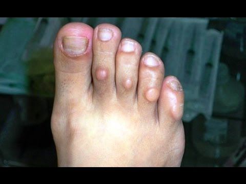 Cuidados de los pies consejos practicos - blog farmacia 24h - Farmacia 24 horas Palma | Farmacia Balanguera