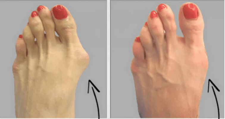 Cuidados de los pies consejos practicos - blog farmacia 24h - Farmacia 24 horas Palma | Farmacia Balanguera