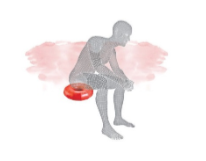 Hemorroides sintomas y tratamiento - blog farmacia 24h - Farmacia 24 horas Palma | Farmacia Balanguera